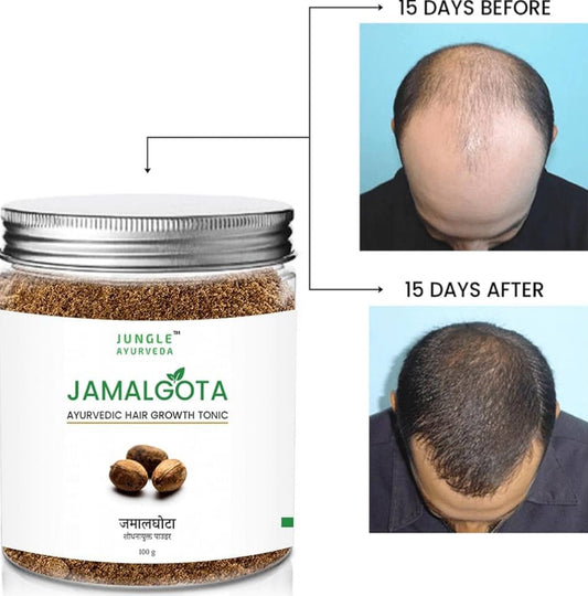 Jamalgota™ Ayurvedic Hair Growth Powder 100gm Buy 1 get 1 free